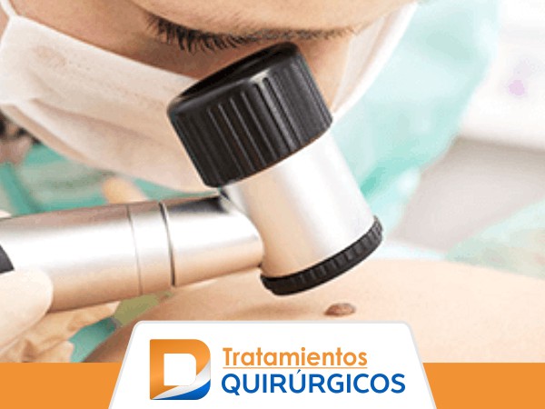 Dercenter-Dermatologia-Quirurgica